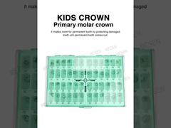 A Closer Look: KIDS CROWN Primary molar crown